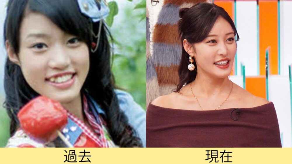 2025最新！王林の顔変わったのはなぜ？理由が整形はデマ！昔画像と比較