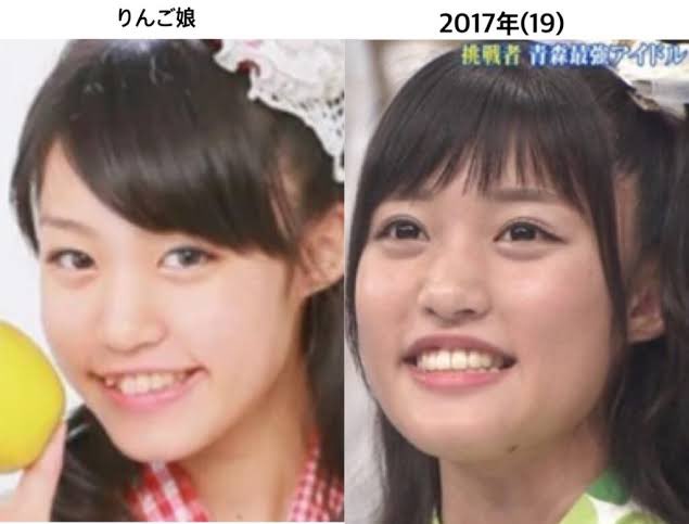 2025最新！王林の顔変わったのはなぜ？理由が整形はデマ！昔画像と比較