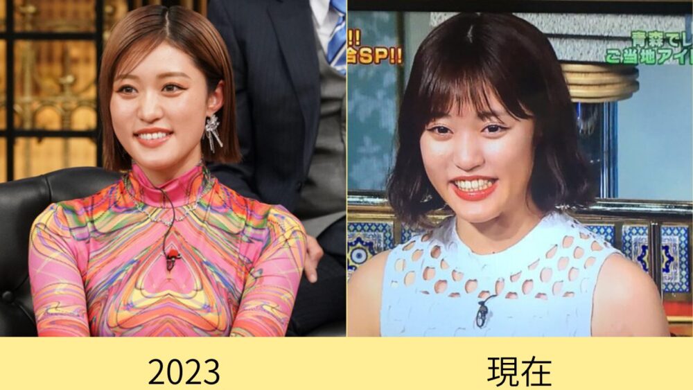 2025最新！王林の顔変わったのはなぜ？理由が整形はデマ！昔画像と比較