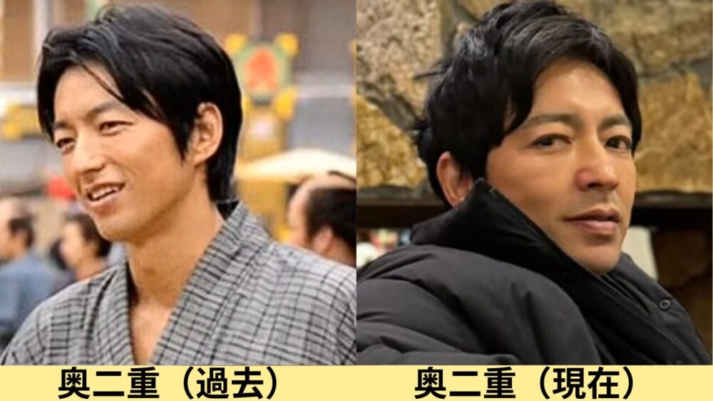 大沢たかお顔変わった