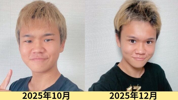 2025最新画像！ゆたぼんの顔変わった？