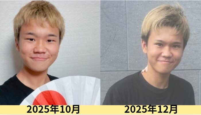 2025最新画像！ゆたぼんの顔変わった？