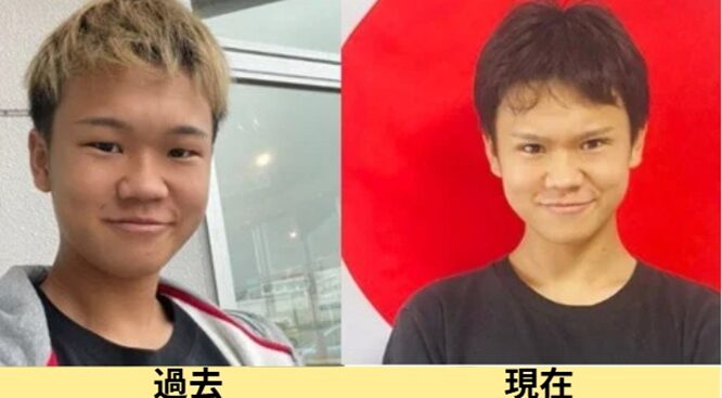 2025最新画像！ゆたぼんの顔変わった？