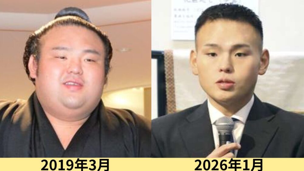 貴景勝顔変わった