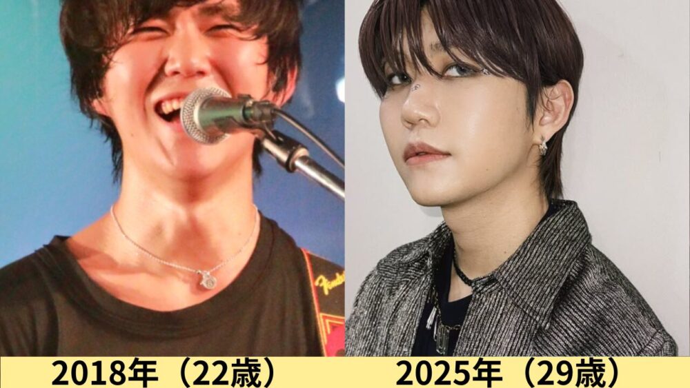 2026最新画像!若井滉斗の顔のタイプは?猫顔!変わったのはいつ?