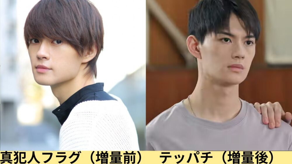 佐野勇斗顔変わった