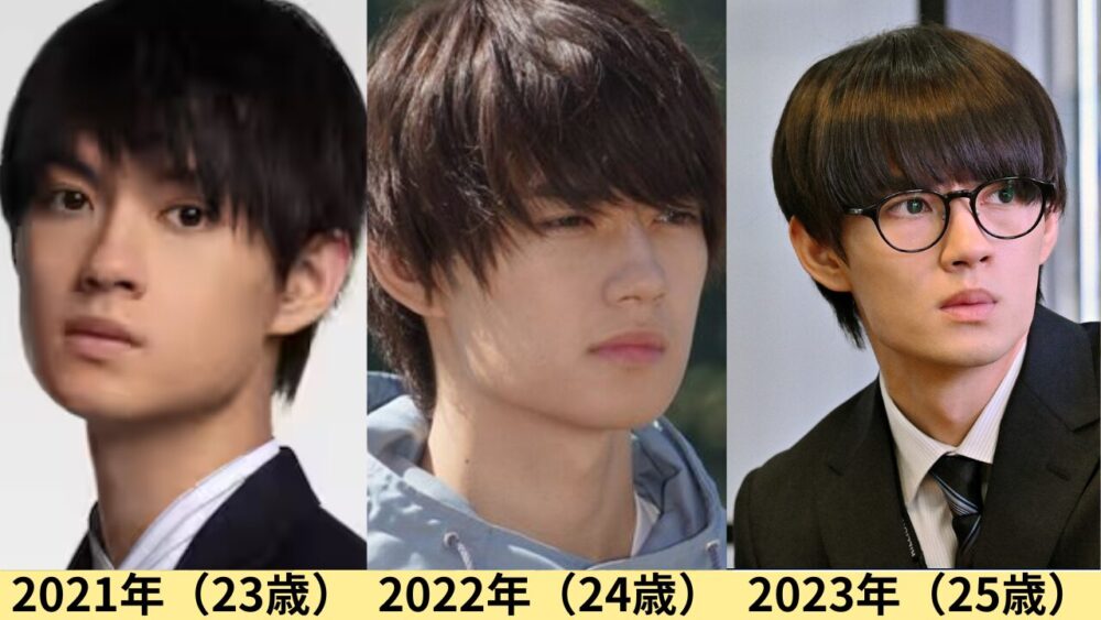 佐野勇斗顔変わった