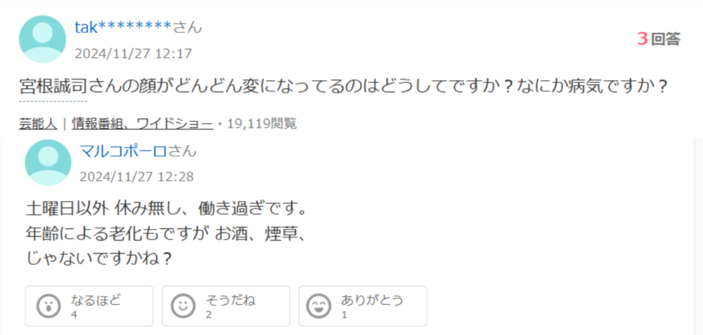 宮根誠司顔変わった