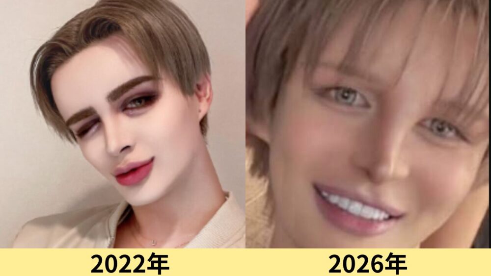 matt　顔変わった