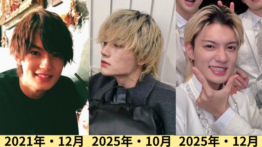 佐野勇斗顔変わった