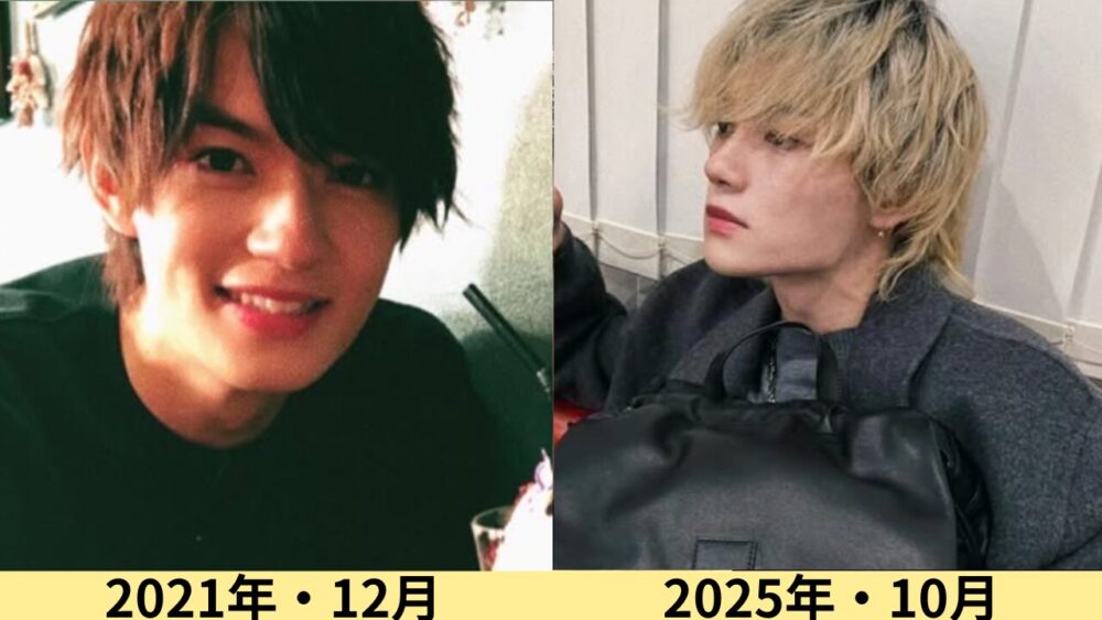 佐野勇斗顔変わった