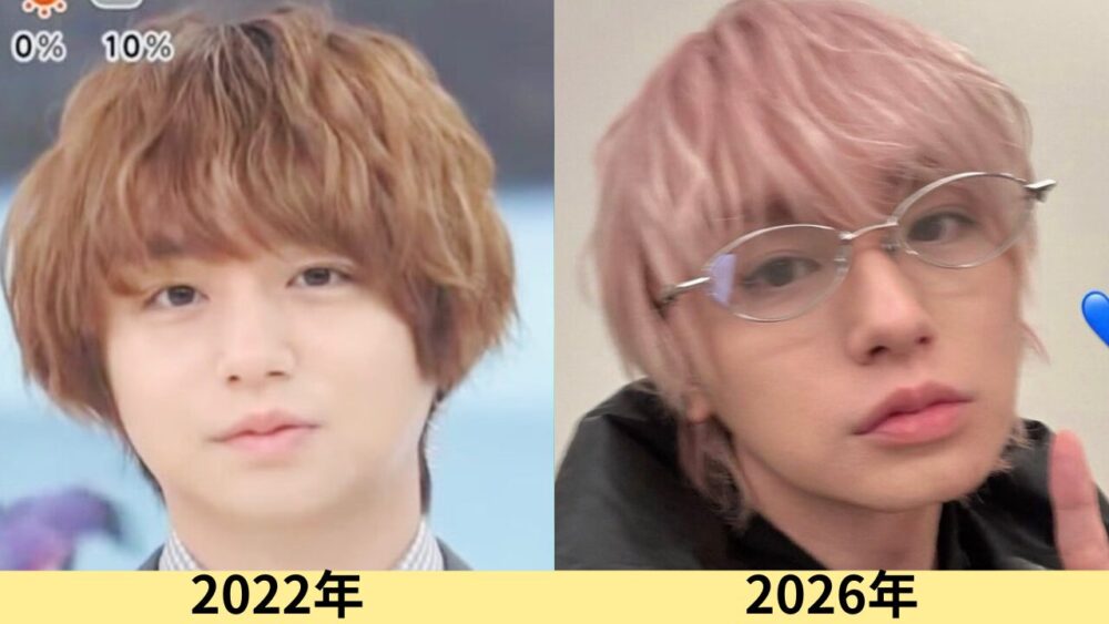 伊野尾慧顔変わった