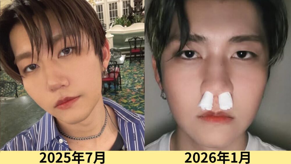 2026最新画像!若井滉斗の顔のタイプは?猫顔!変わったのはいつ?