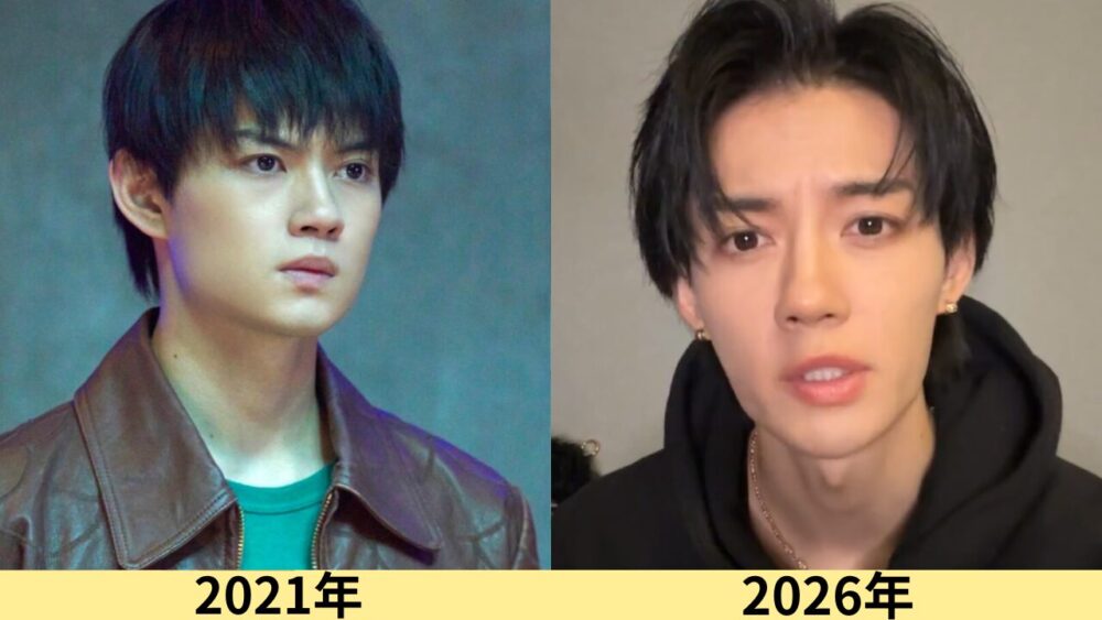 佐野勇斗顔変わった