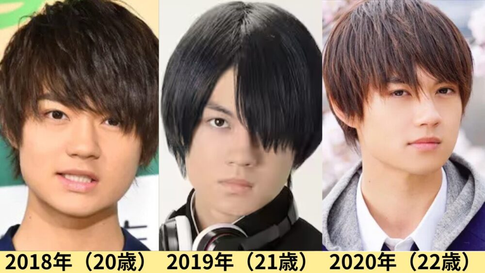 佐野勇斗顔変わった