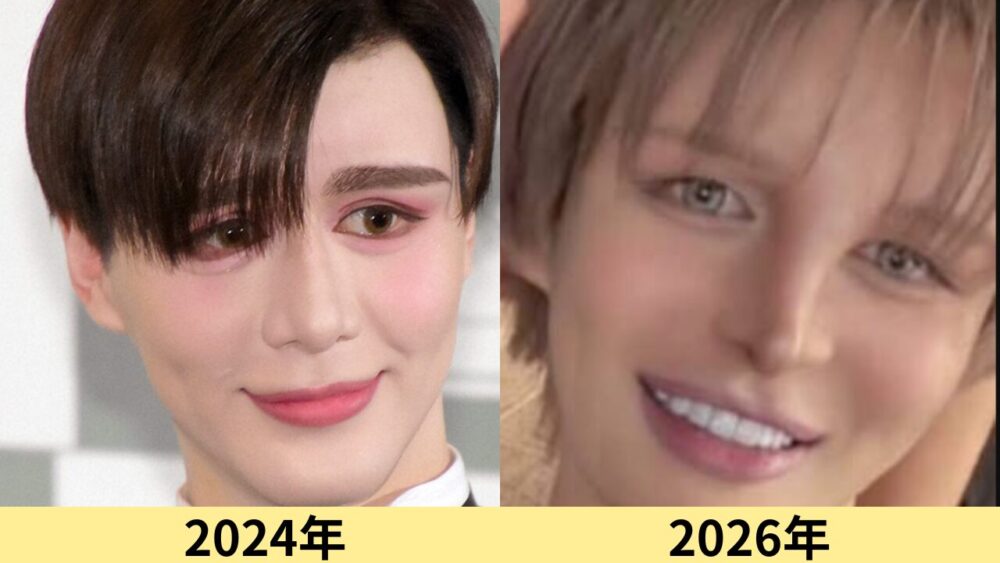 matt　顔変わった