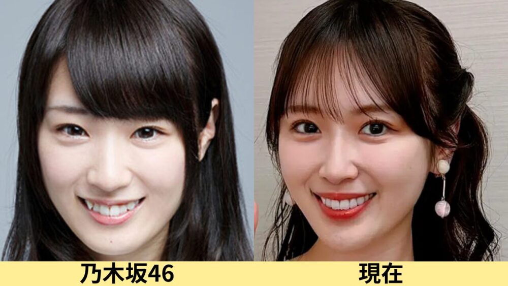 高山一実顔変わった