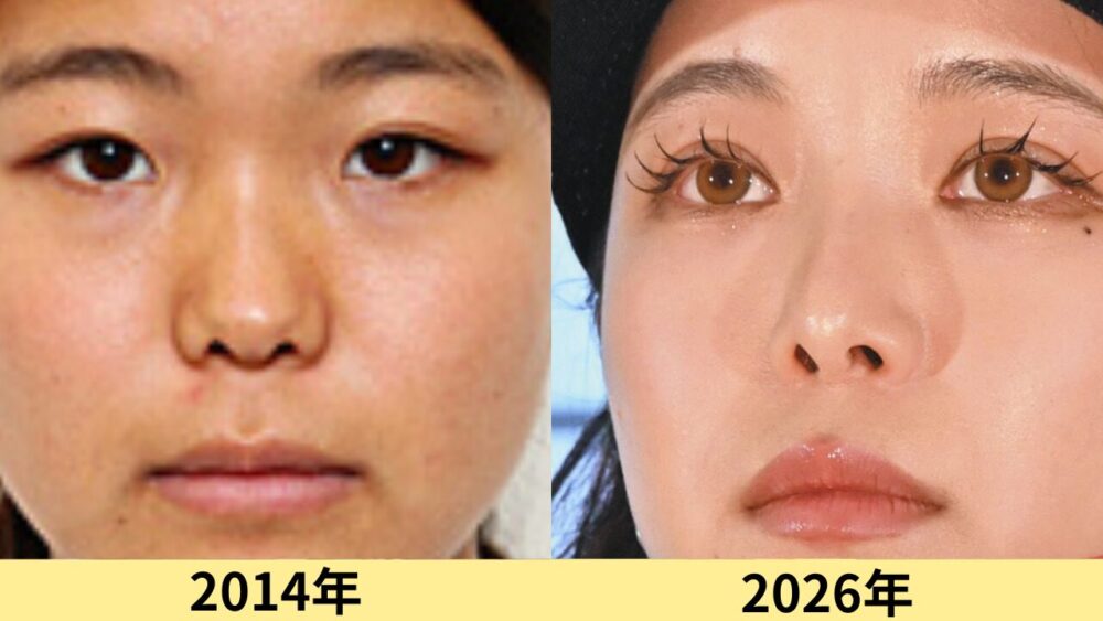 高梨沙羅顔変わった