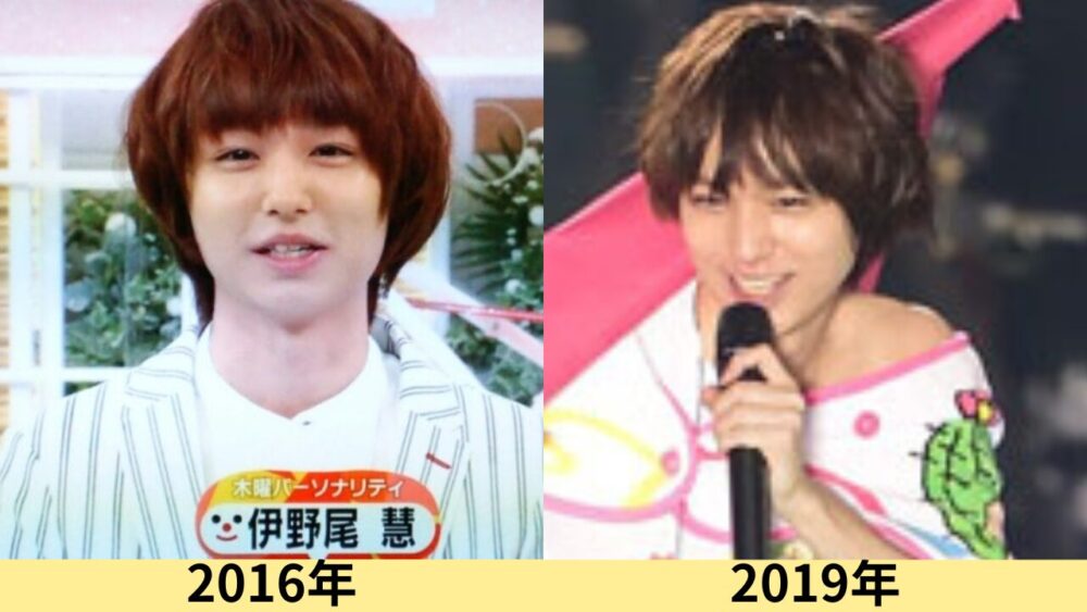 伊野尾慧顔変わった