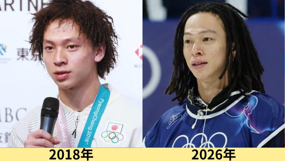 平野歩夢顔変わった