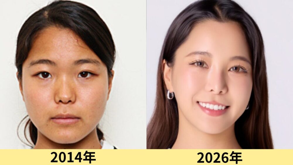 高梨沙羅顔変わった