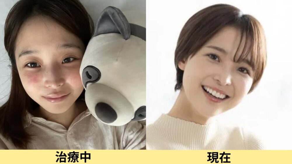 渡邊渚顔変わった