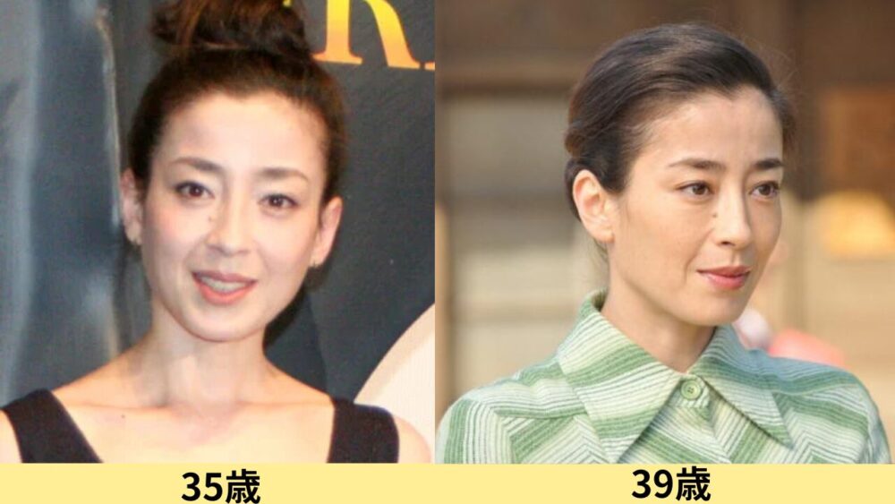 宮沢りえ顔変わった