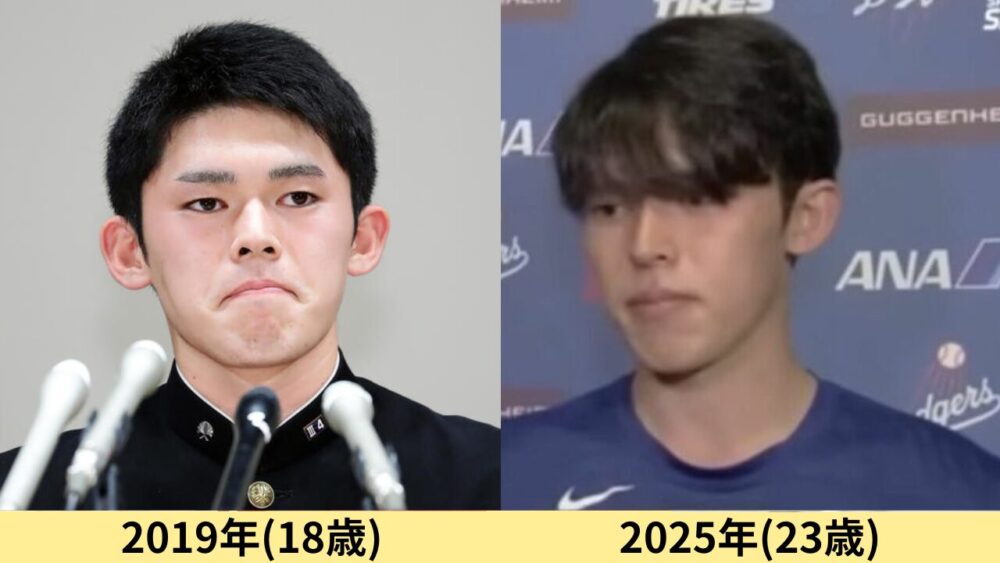 佐々木郎希顔変わった