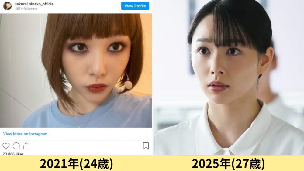 桜井日奈子顔変わった