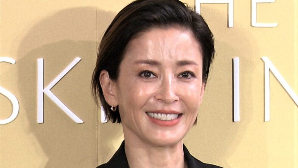 宮沢りえ顔変わった