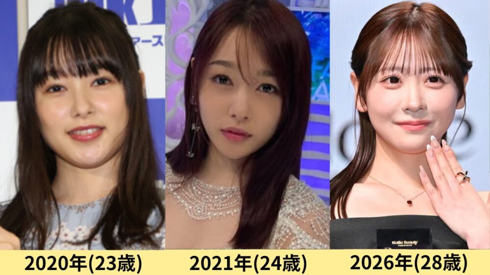 桜井日奈子顔変わった