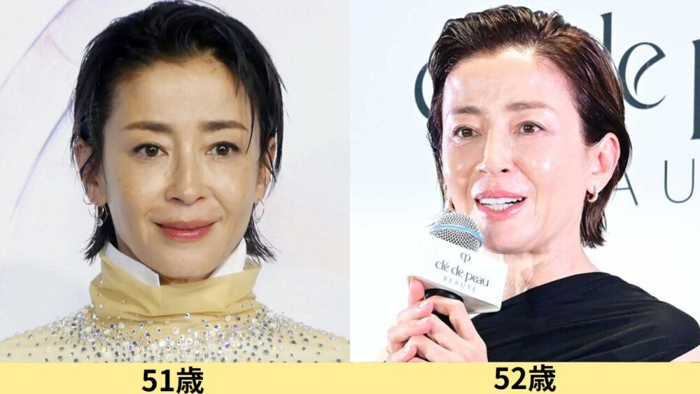 宮沢りえ顔変わった