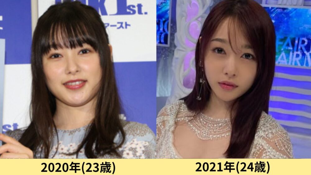 桜井日奈子顔変わった