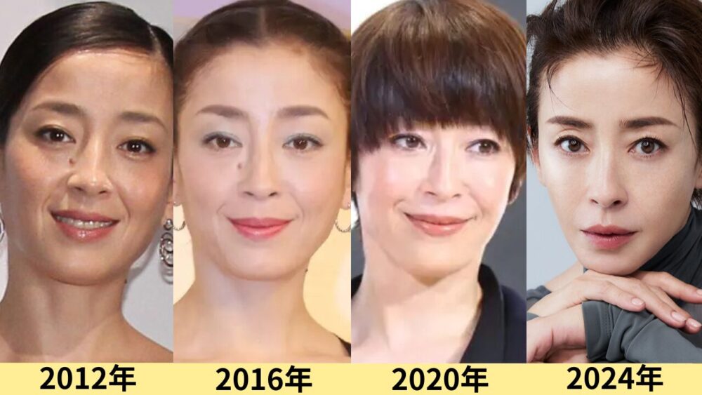 宮沢りえ顔変わった