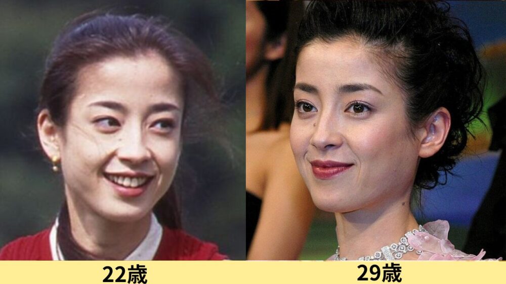 宮沢りえ顔変わった