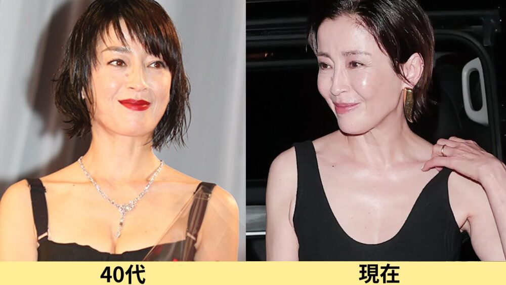 宮沢りえ顔変わった