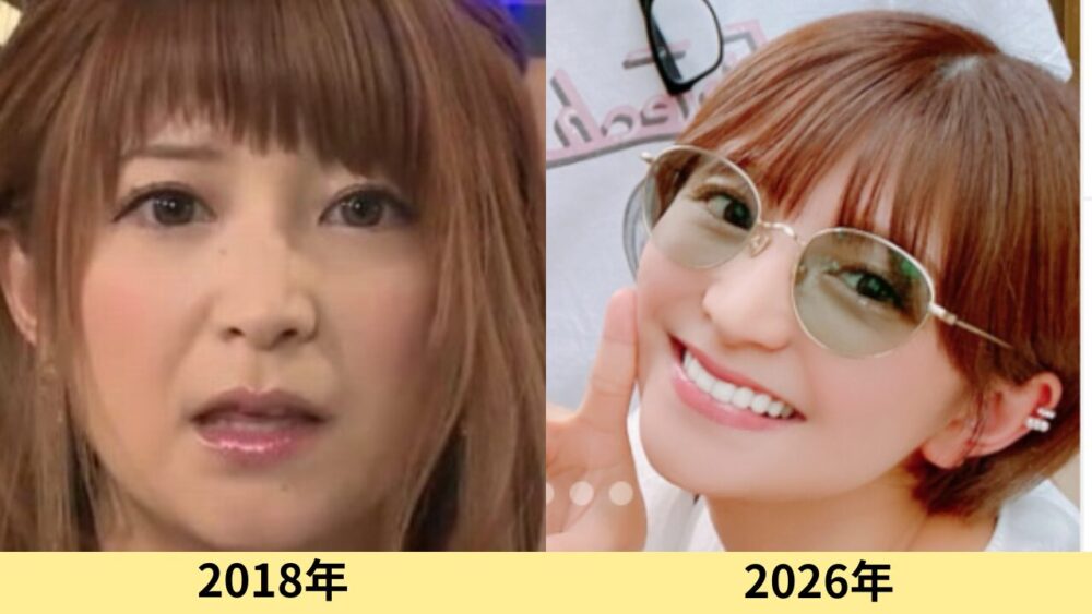 矢口真里　顔変わった