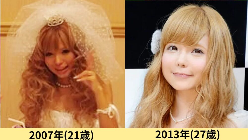 益若つばさ顔変わった