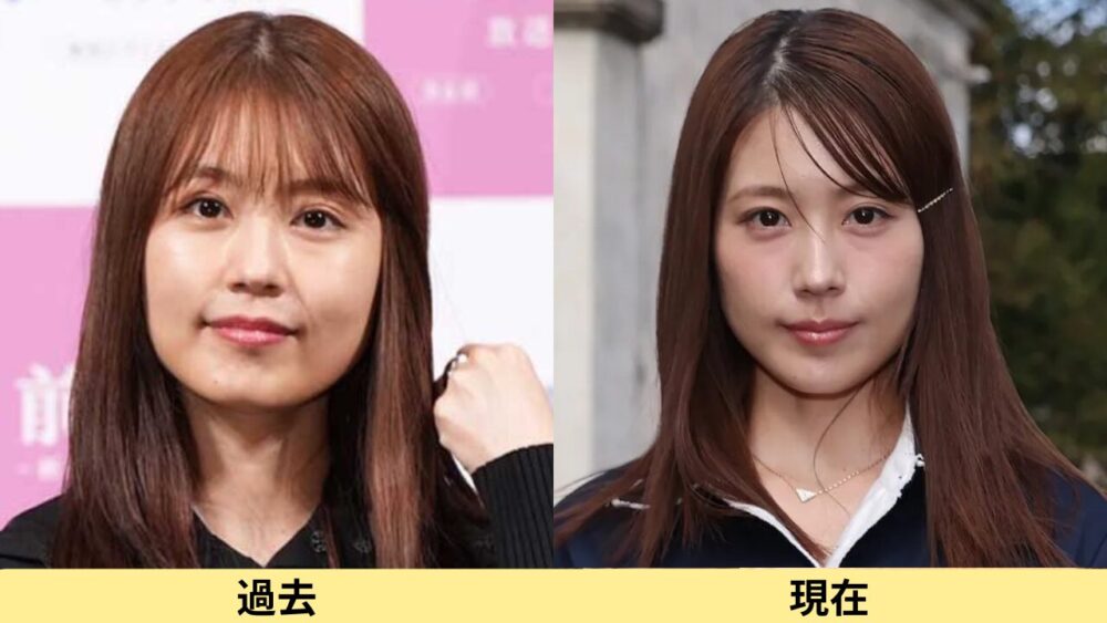 有村架純顔変わった