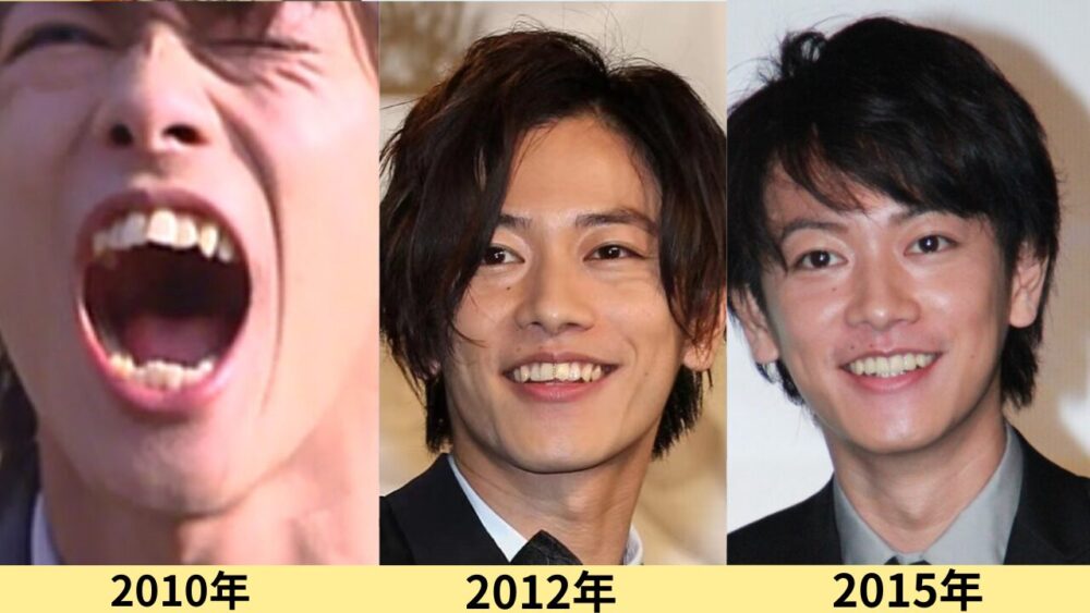 佐藤健顔変わった