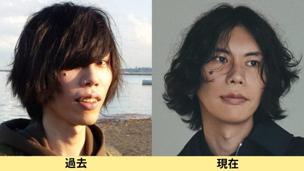 米津玄師顔変わった