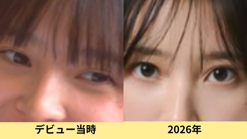 飯沼愛　顔変わった