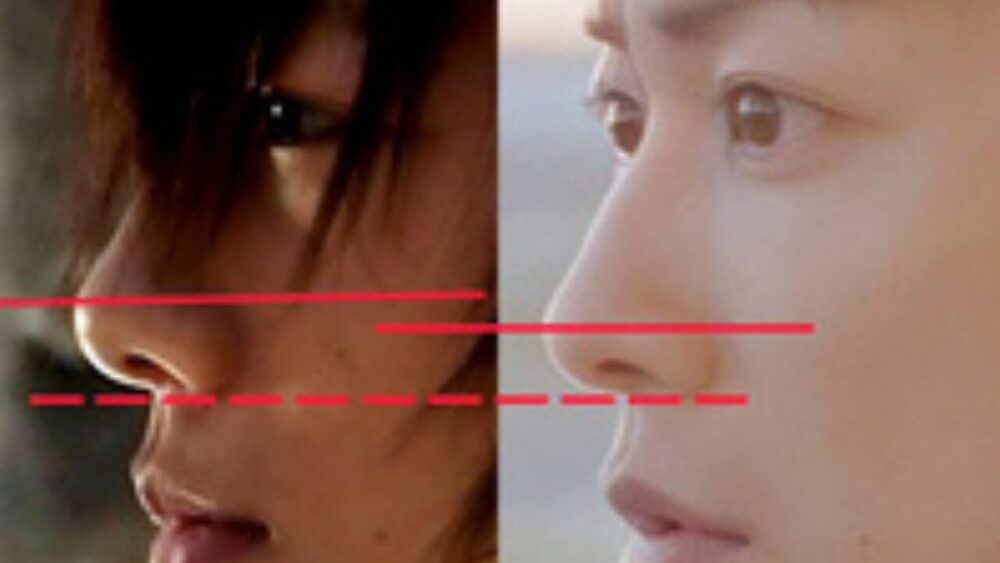 佐藤健顔変わった