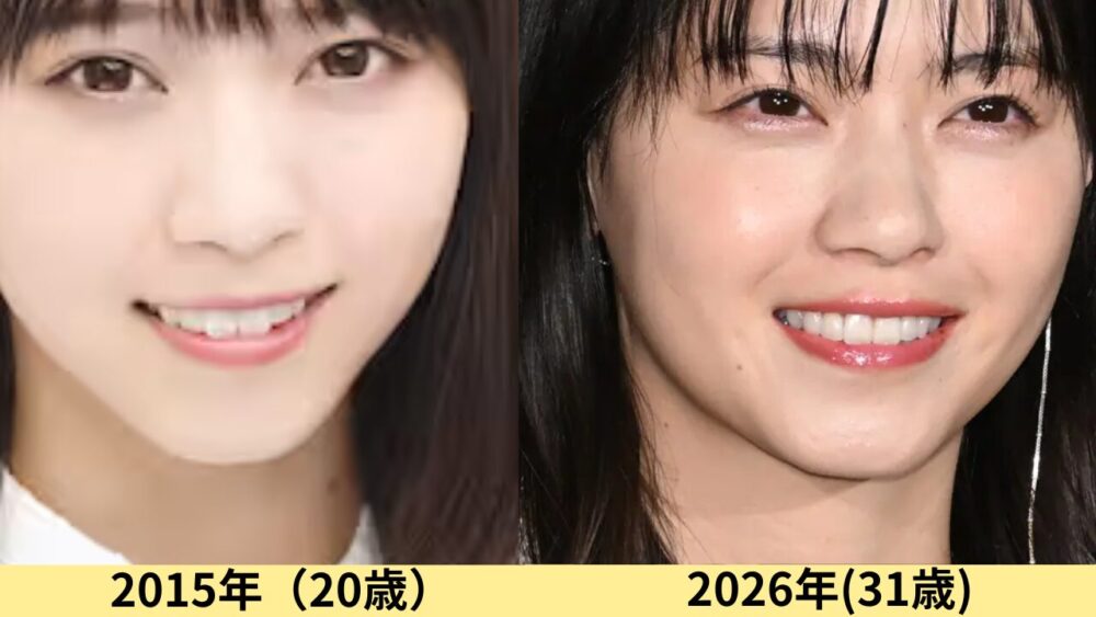 西野七瀬顔変わった