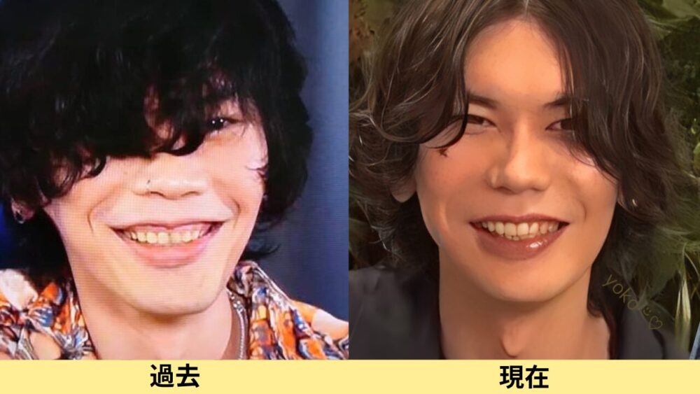 米津玄師顔変わった