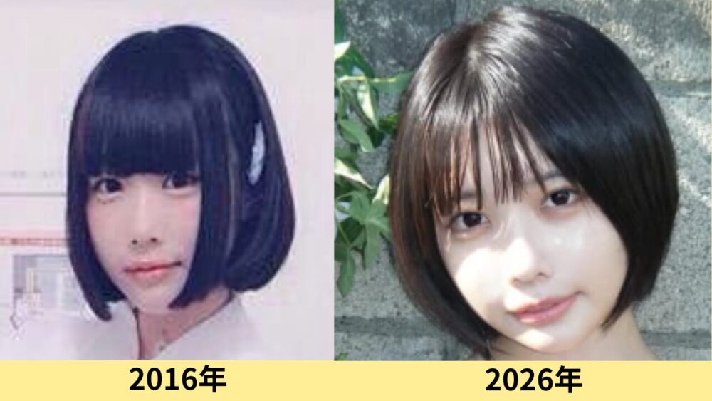 あのちゃん　顔変わった