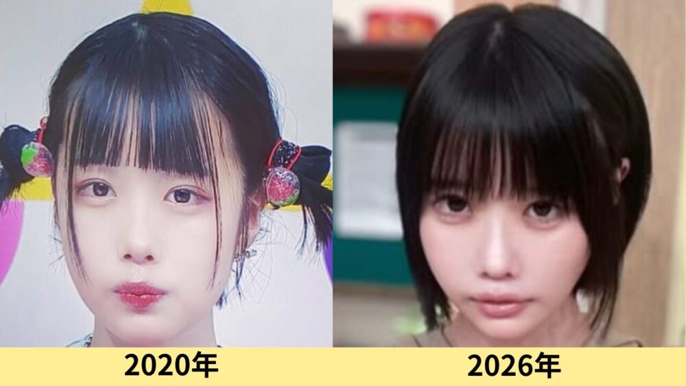 あのちゃん　顔変わった