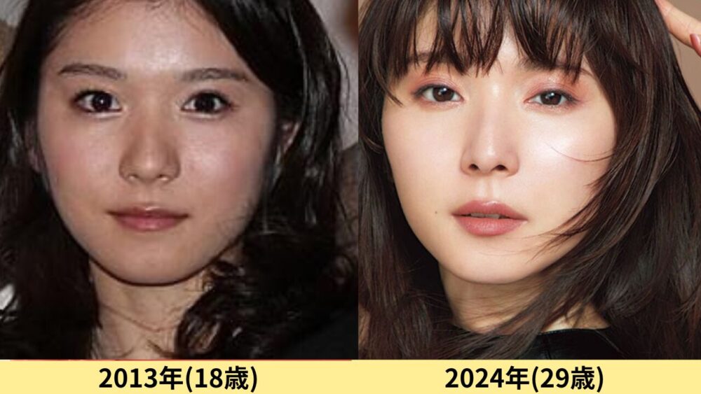 松岡茉優顔変わった