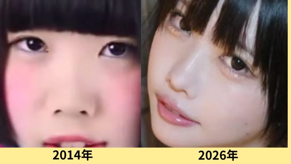 あのちゃん　顔変わった
