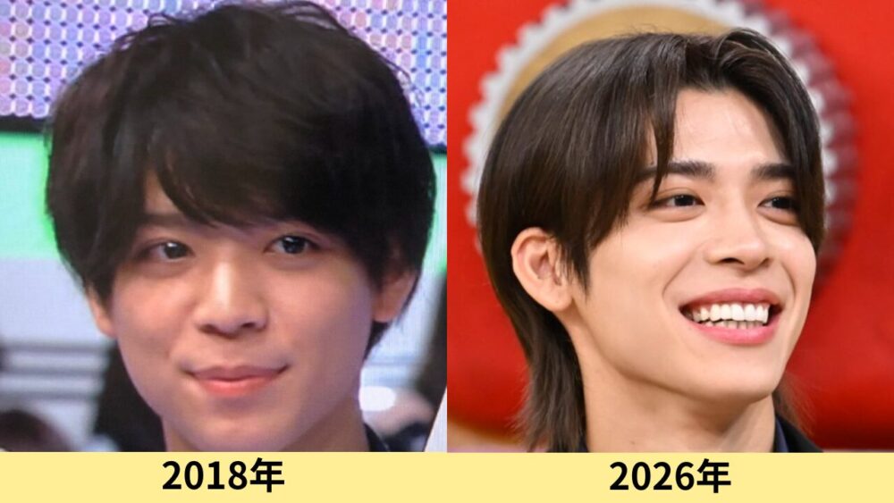 松島聡　顔変わった